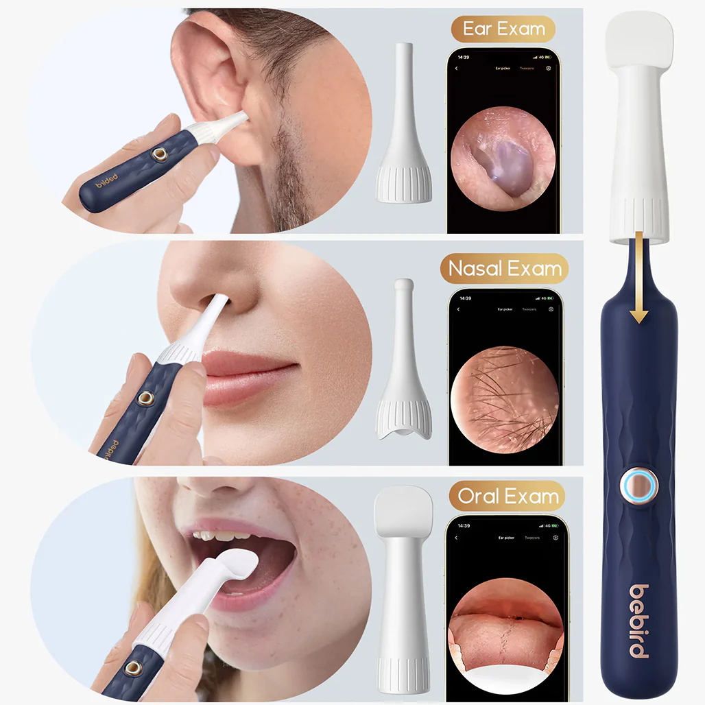 Bebird EarSight Plus Smart Visual Ear Cleaner - Advanced, Portable, and Precise - Image 5