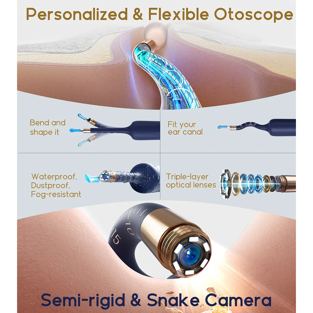 Bebird EarSight Plus Smart Visual Ear Cleaner - Advanced, Portable, and Precise - Image 6