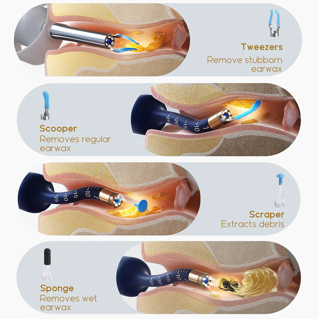 Bebird EarSight Plus Smart Visual Ear Cleaner - Advanced, Portable, and Precise - Image 7
