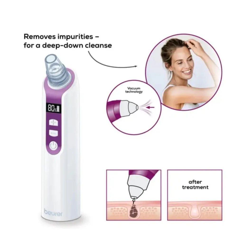 Beurer FC 41 Power deep pore cleanser - Image 6