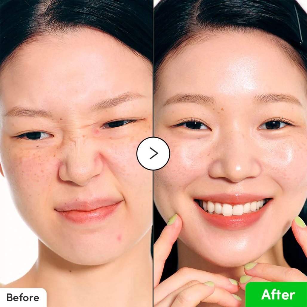 EQQUALBERRY Aloe PDRN Calming Serum - Image 3