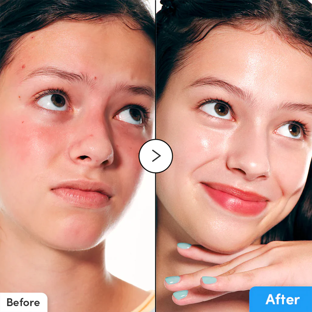 EQQUALBERRY Hyaltoin Flooding Serum - Image 3