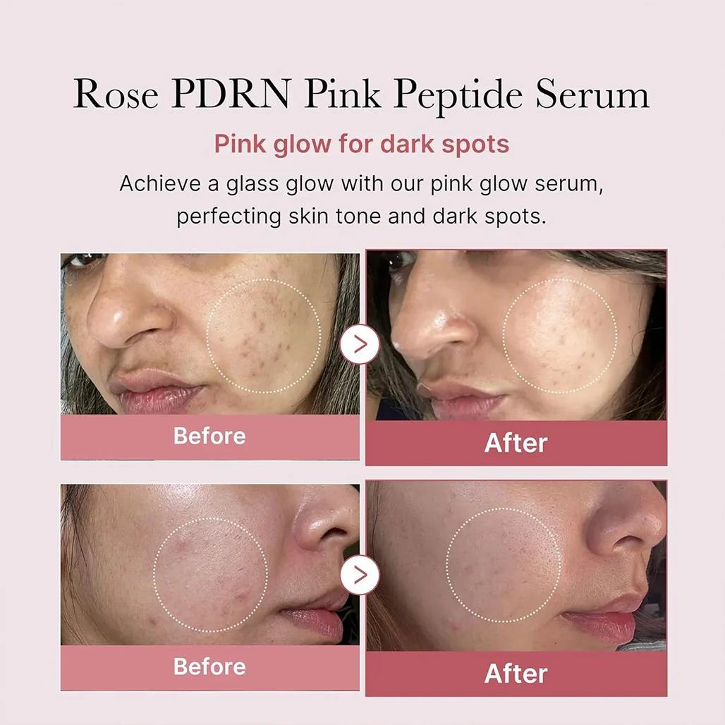 Medicube PDRN Pink Peptide Serum - 30ml - Image 9